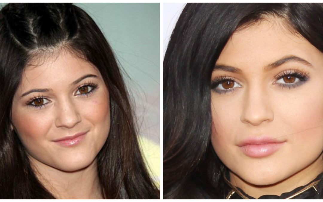 Márcate un Kylie Jenner consiguiendo unos labios jugosos